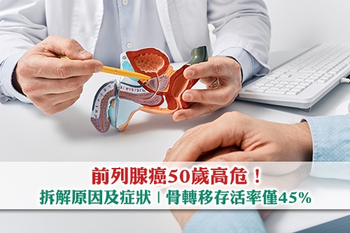 前列腺癌50歲高危-拆解原因及5大症狀-骨轉移存活率僅45%