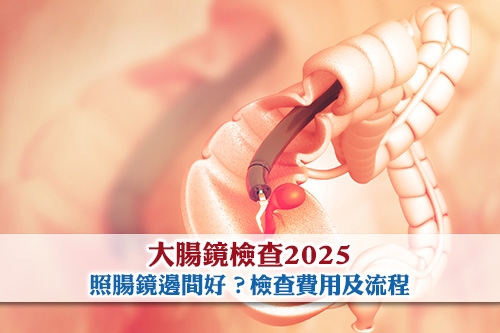 大腸鏡檢查2025-照腸鏡邊間好-大腸鏡檢查費用-大腸鏡檢查流程