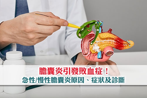 膽囊炎引發敗血症-急性慢性膽囊炎原因及症狀-診斷及飲食禁忌