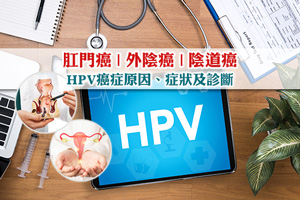 News: 【HPV癌症】肛門癌| 外陰癌| 陰道癌原因、症狀及診斷