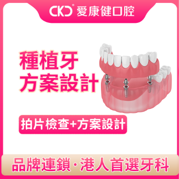 图片 爱康健口腔 口腔种植检查 图片 爱康健口腔 口腔种植检查